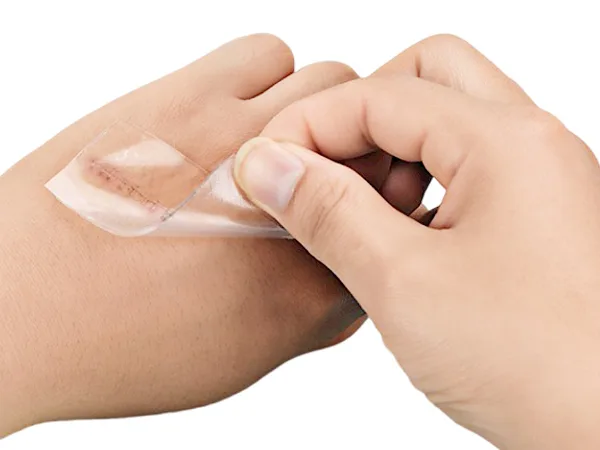 Miếng dán sẹo gel silicone